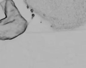 Art of Prostate Tugging