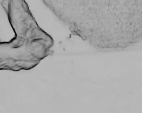 Art of Prostate Tugging