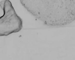 Art of Prostate Tugging