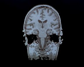 Naked scenes Kate Winslet nude - Iris (2001)