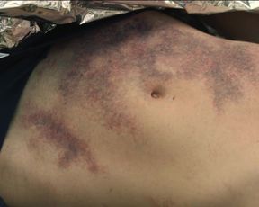 Caterina Biasiol, Sabrina Martina naked - Il silenzio dell'acqua (2019) (Season 1, Episode 1,2,3,7,8)