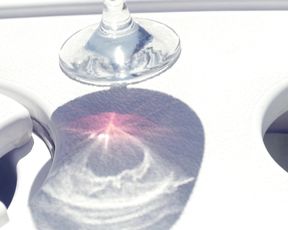 Naked on Stage - Portside