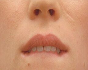 Dana Thompson nude - Dr Nazi (2011) Art Scene Close-Ups