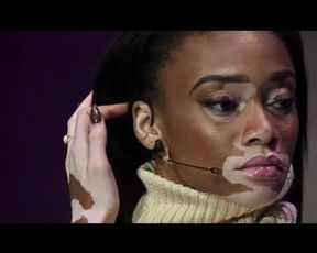 Winnie Harlow nude in Instagram