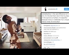 Winnie Harlow nude in Instagram